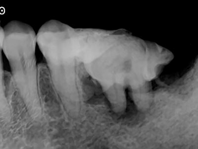 術後X線画像：症例2-9